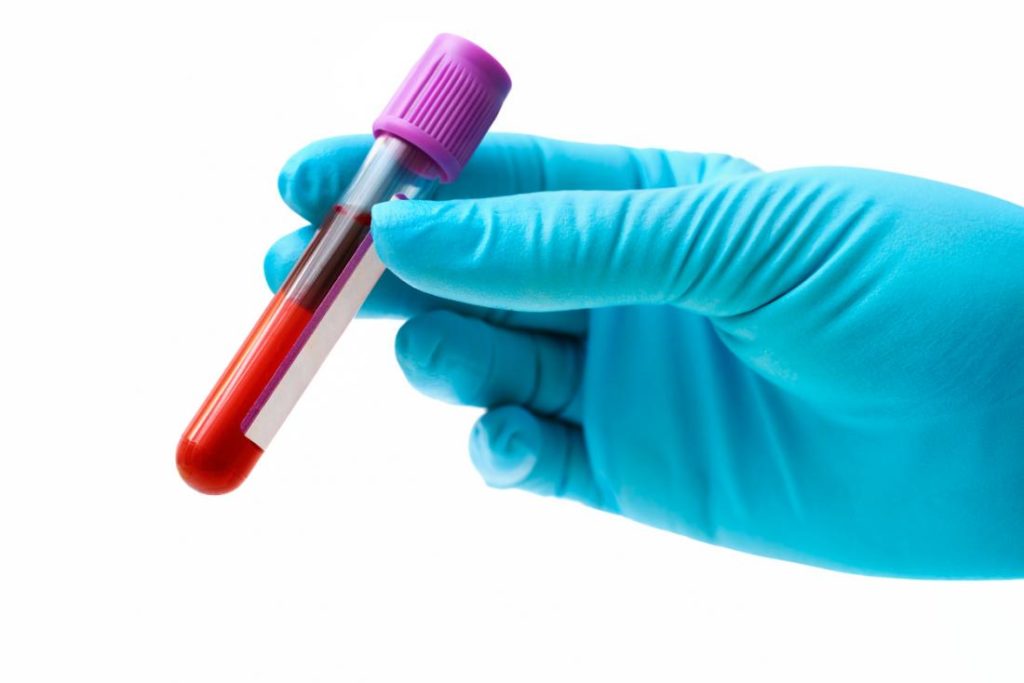 анализ крови днк теста